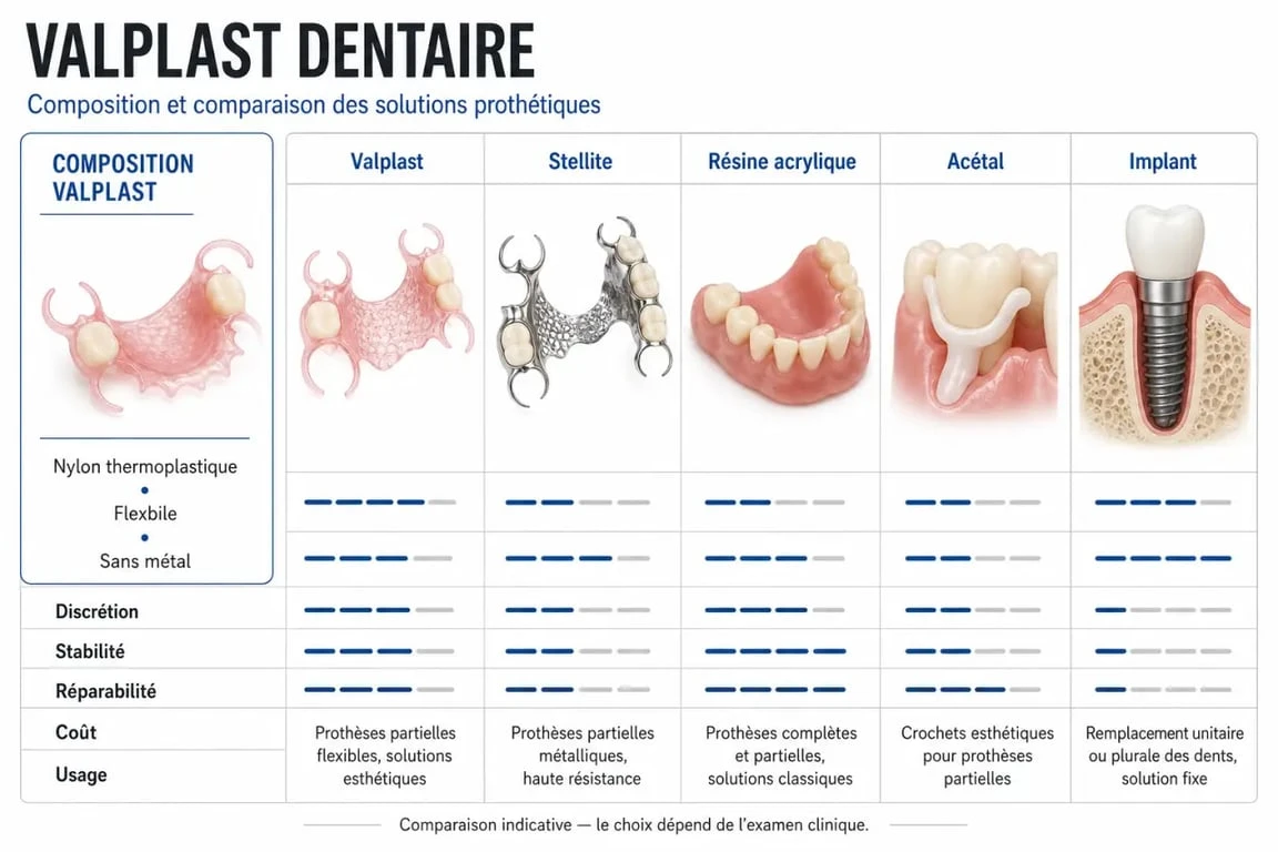 Comparaison du valplast dentaire avec stellite, résine, acétal et implant