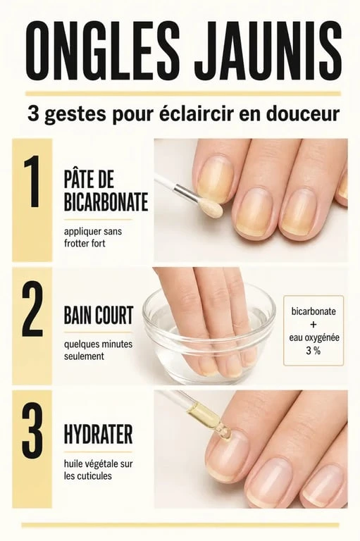 Blanchir ongles jaunis avec bicarbonate, citron et hydratation dans un visuel éditorial
